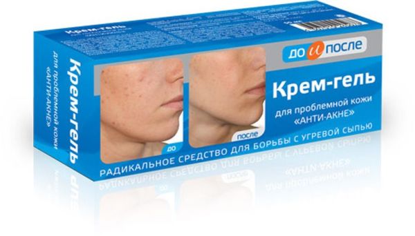 Изображение товара Крем-гель для проблемной кожи «До и после» анти-акне, 50 мл Крем-гель для проблемной кожи «До и после» анти-акне, 50 мл фотография